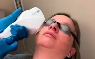 Luz pulsada para el ojo seco: ¿es la solución que necesitás?