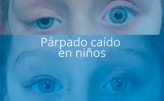 Párpado Caído en Niños: No es Solo una Cuestión Estética